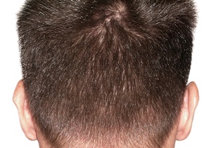 donor-area-before.jpg